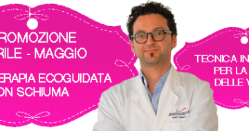 Scleroterapia ecoguidata con schiuma