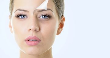 Cos'è il peeling e a cosa serve